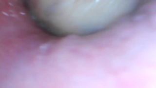 Milly17 endoscope play part tattoo -7