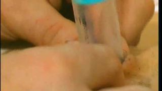 - PERVERSIONS GYNECOLOGIQUES TELSEV Sex Clip Video Porn D...-9