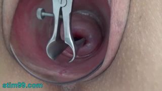 Cervix insertion - Open cervix with speculum and semen i...-5