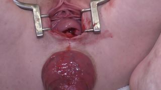 7200 Vaginal fisting, Anal fisting 9-8
