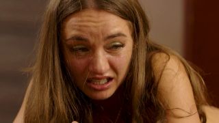 Whip strokes on sunburnt skin - part 4 1080P - Dr.lomp-0