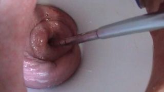 cervix-fucking-2 Video Sex Download Porn-2