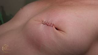 Medical intervention - sadistic nurse staples -  ball busting-8