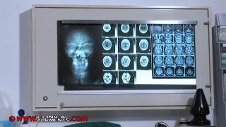 clinicaltorments-clip092.-2