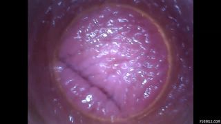 free porn clip 10 RAW endoscopic video | fetish | femdom porn amateur fetish porn-3