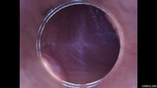 free porn clip 10 RAW endoscopic video | fetish | femdom porn amateur fetish porn-5