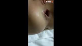 Kinky Girl Kitty25 Loose Her Really Big Anal Prolapse And...-4