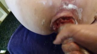 Masterofanal2 Bbw Extreme Anal Play Sex Clip Video Porn D...-6