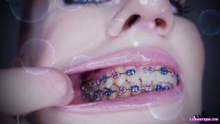 free porn clip 9 LDBmistress - Braces Brainwash - ldbmistress - femdom porn fetish examples-2