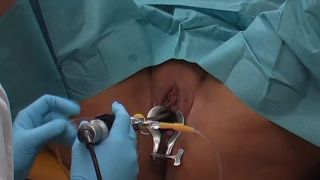 Spekula Bladder exam cystoscopy.-0