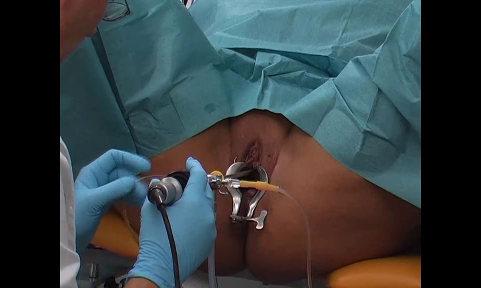 Spekula Bladder exam cystoscopy.