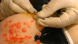 Mega-Extrem-NeedlesPins Sex Clip Video Porn Download Mp4-9