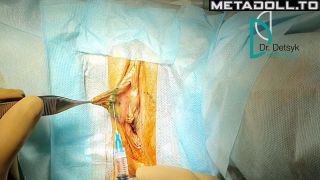 Metadoll.to - Gynecological medical films 45-1