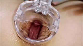 Solo Female Speculum in ass Gaping wide Ass hole Close up Fetish-2