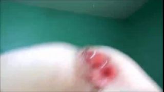 Bbw Anal Slave Amazing Prolapse Loose Again Closeup Sex C...-8