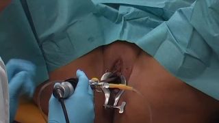 Spekula mov 84 Bladder exam cystoscopy (mp4)-4