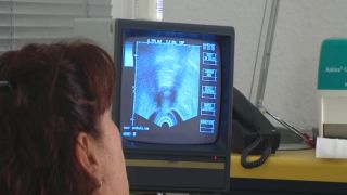 Spekula Ultrasound gyn masturbation.-6