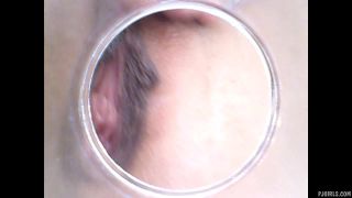 RAW endoscopic video-4