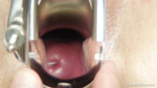 Mazzy Gyno Exam-5