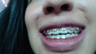 M@nyV1ds - mia_isabella3 - Braces, mouth, uvula fetish-1