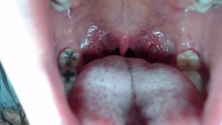 M@nyV1ds - mia_isabella3 - Braces, mouth, uvula fetish-5