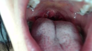 M@nyV1ds - mia_isabella3 - Braces, mouth, uvula fetish-6