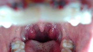 M@nyV1ds - mia_isabella3 - Braces, mouth, uvula fetish-7