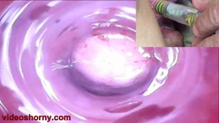 Cervix insertion - Peehole play urethral sounding endosc...-0