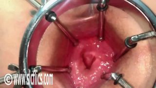 xxx video clip 15 amateur gay anal Mabel - Fisting Mabels gaping ass, climax on fetish porn-5