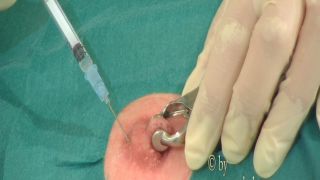 Intensive care - needle orgasm Quick View Porn - New Sex ...-3