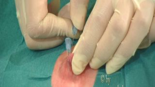 Intensive care - needle orgasm Quick View Porn - New Sex ...-8