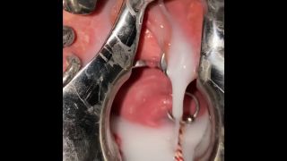 Piercing sletje - Extreme cervix sounding-6