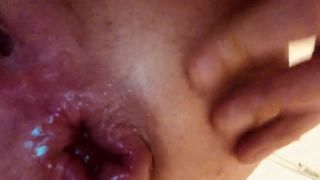 My fist belongs in my swollen asshole Video Sex Download ...-9