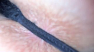 Look My ass will never be the same! Just look on it close up when I’m 18 years old-2