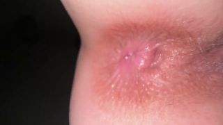 Look My ass will never be the same! Just look on it close up when I’m 18 years old-9