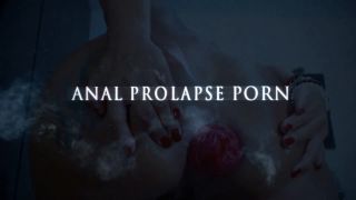 Free Private Anal Prolapse Porn With Young Teen Vixenxmoo...-9