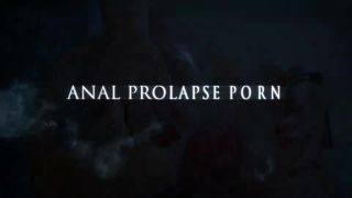 Very sexy latina goddess loose her creamy anal prolapse V...-9