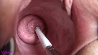 cervix Sex Clip Video Porn Download Mp4-7