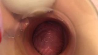 Real Extreme Videos Coral Fisted Fucked Amp Creampied Ee ...-3