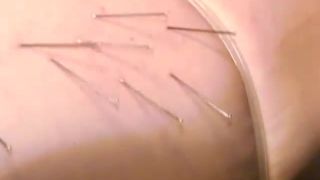 SNI-11 Nii Human Specimen No. 13, Its Pain Beauty Sex Onl...-2