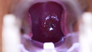 7196 Pregnant girl 5-1