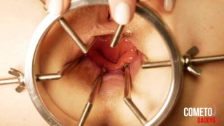 My Horny Asian Wife Cometodaddy G Speculum Anal Examinati...-7