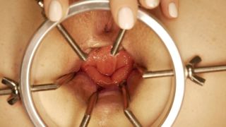 My Horny Asian Wife Cometodaddy G Speculum Anal Examinati...-9