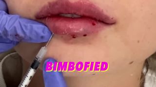adult xxx video 39 Kimber Haven - Turn Betas Into Bimbos Part1 Lip Augmentation [HD 720p] | fetish | fetish porn calf fetish-2