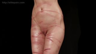free video 9 Dr. Lomp 05 on fetish porn leotard fetish-7
