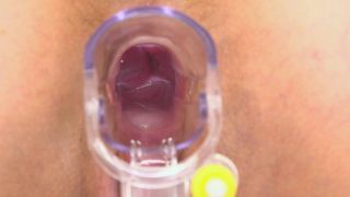 Exciting Night Uncensored 030525-001.mp4 Full Episode Reveal-0