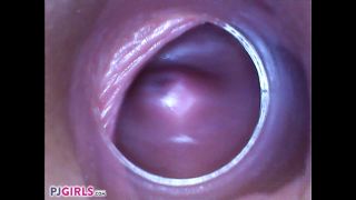 RAW Endoscopic Video Fisting-7