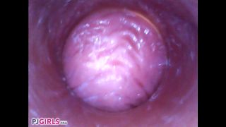 video 38 RAW Endoscopic Video | gyno | brunette girls porn blonde sex porn-5