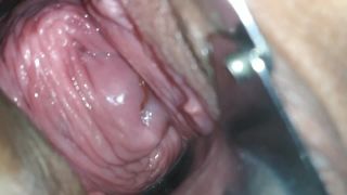 Russian Kristinaslut Speculum Examination And Pussy Prola...-1