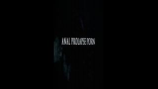 Big Labia Wife Penetration Big Black Dildo In Her Wet Ana...-9